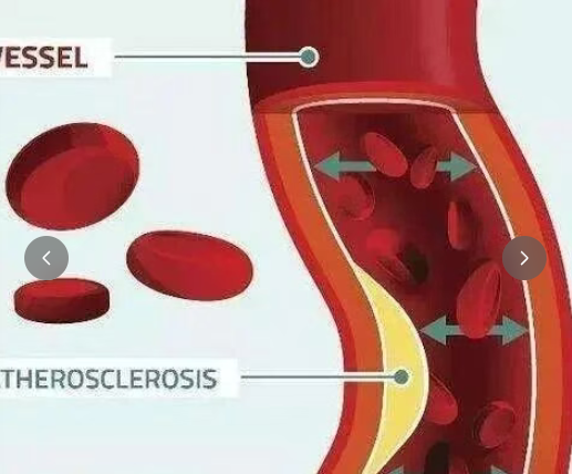 20251109135119876-image