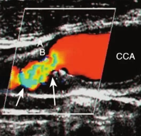 20251109135155187-image