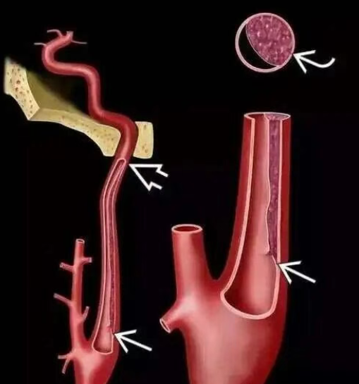 20251109135219544-image